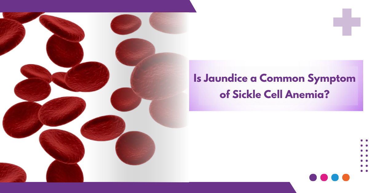 Is Jaundice a Common Symptom of Sickle Cell Anemia?